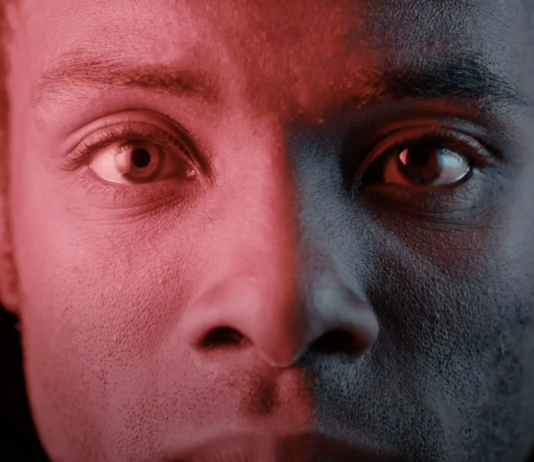 Firsthand: “The Skin We’re In” (S2 | E14) – CBC Documentary